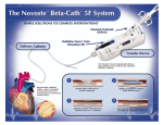 Beta-Cath™ 5F System Overview