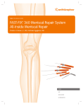 FAST-FIX™ 360 Meniscal Repair System All