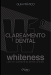 Técnica de Clareamento Caseiro Protocolo Whiteness