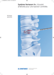 Système Vertecem V+. Viscosité améliorée pour une injection