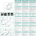 OPUS™360 NASAL PILLOWS MASK Patient Instructions For Use