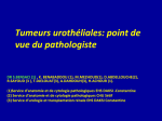 Tumeurs urothéliales