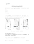 XiO: Motorized Wedge の MU 計算