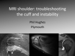 MRI shoulder: troubleshooting the cuff and instability