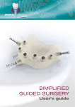 Simplified guided surgery user`s guide