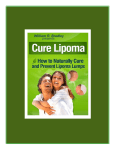Forward - Cure Lipoma
