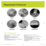 Placement Protocol