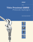 gmrs proximal tibial