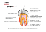 Propex Pixi TC