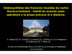 Ost&eacute;osynth&egrave;se des fractures r&eacute;centes du rachis thoraco