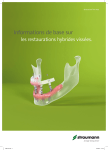 Informations de base sur les restaurations hybrides
