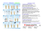 SNOWPOST®, SNOWLIGHT®, CARBOPOST®