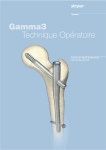 Gamma3 Technique Opératoire
