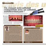 Dentoscope 54_Testé Pour Vous_Maxcem Elite_Dr Paul Azoulay