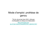 Mode d`emploi: prothèse de genou