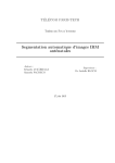 Segmentation automatique d`images IRM ant&eacute;natales