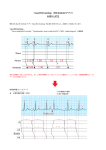 『easy ECG training』（iOS/Android アプリ） お詫びと訂正